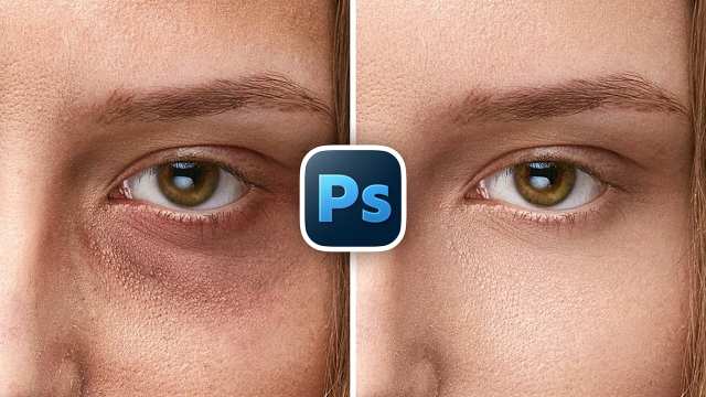Remove Eye Bags with High-End Retouch in Photoshop